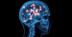 Comprendre les maladies dites imaginaires