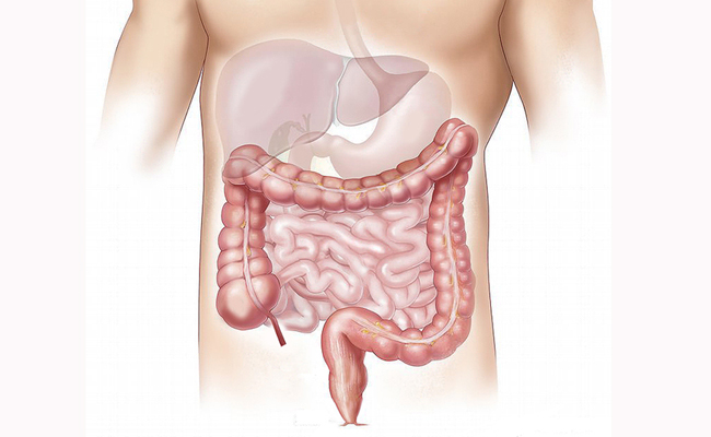 constipation et dysfonctionnement des intestins