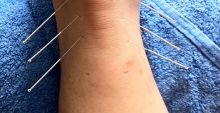 Le lumbago : comment s'en prémunir et comment se soulager ?